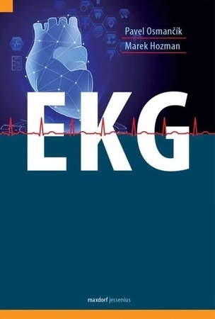 EKG