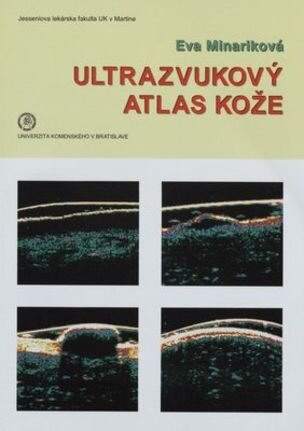 Ultrazvukový atlas kože (Eva Mináriková