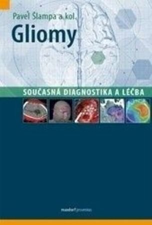 Gliomy – současná diagnostika a léčba