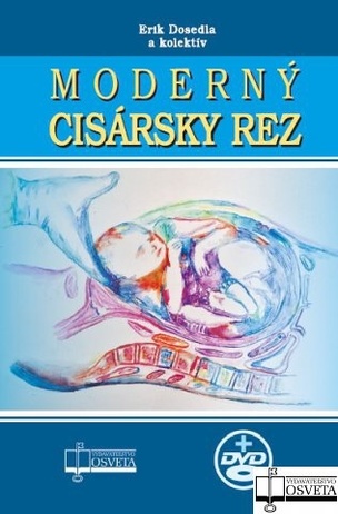 Moderný cisársky rez + CD