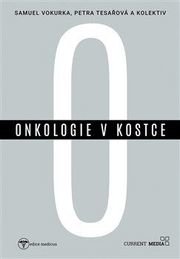 Onkologie v kostce