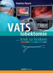VATS lobektomie krok za krokem